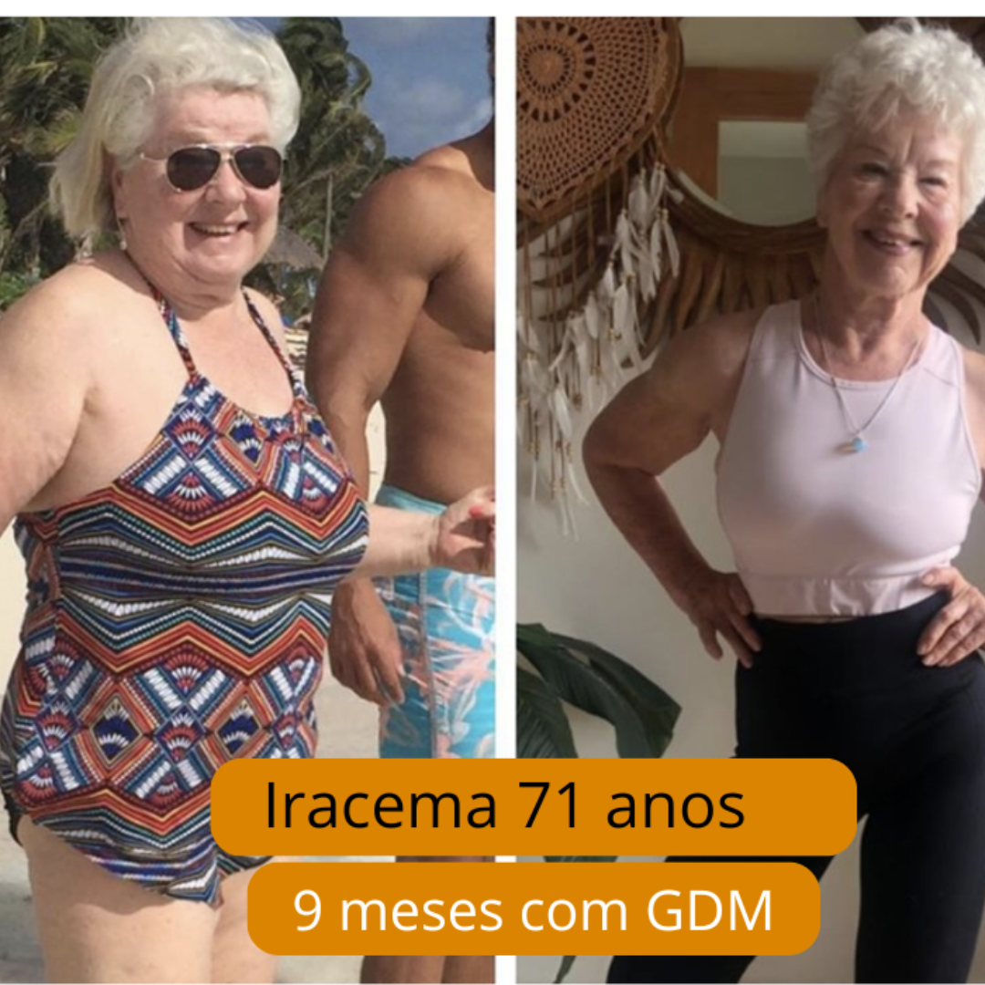 Iracema